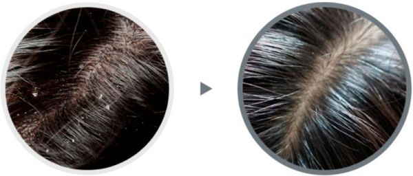 Шампунь Lador Anti-Dandruff от перхоти 530 мл