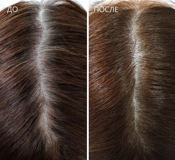 Шампунь 2 в 1 Adelline Bio Biotin против выпадения волос 100 мл