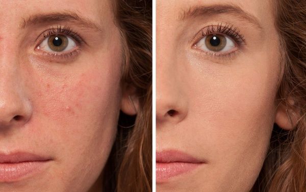 Консилер L'Oreal Paris 2R Vanille 6,8 мл