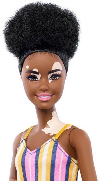 Кукла Barbie Fashion&Vitiligo