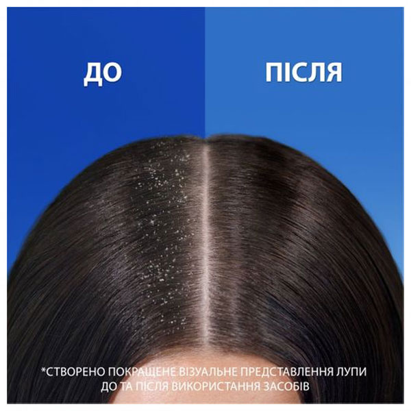Шампунь Head & Shoulders Цитрус 2-в-1 625 мл