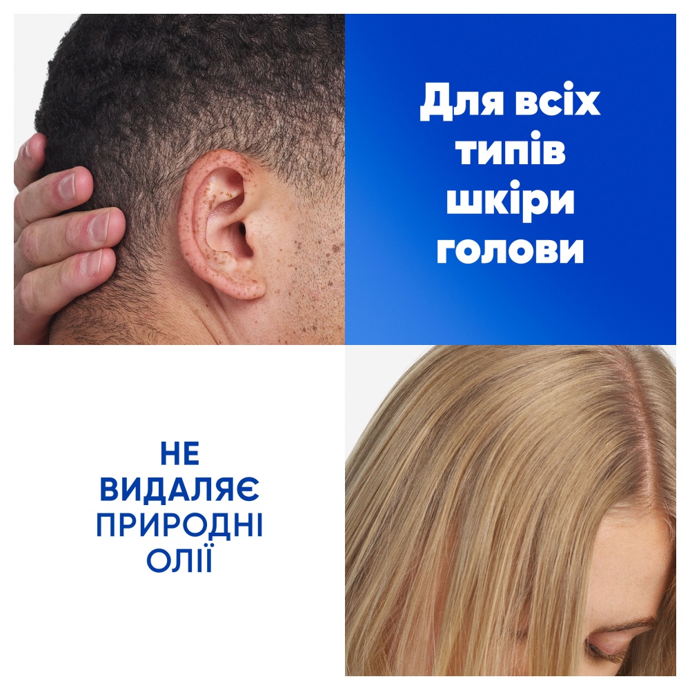Шампунь Head & Shoulders Яблочная свежесть 800 мл