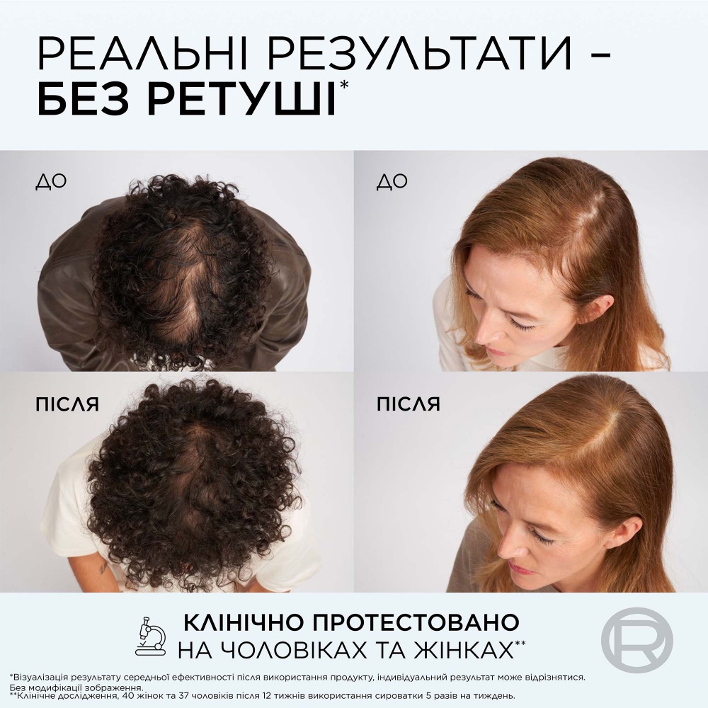 Сыворотка Elseve для борьбы с выпадением и ломкостью волос Growth booster 102 мл