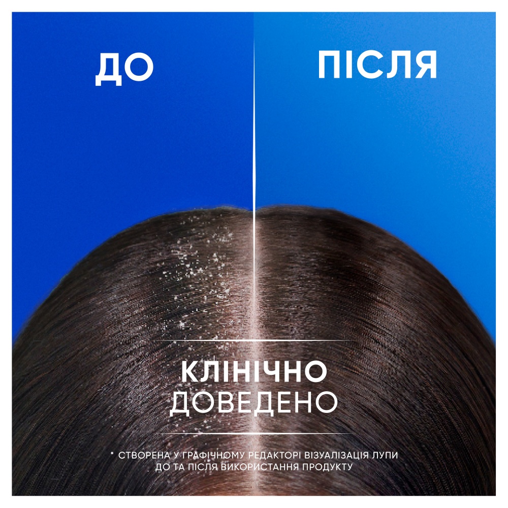Шампунь Head & Shoulders Яблочная свежесть 2-в-1 330 мл