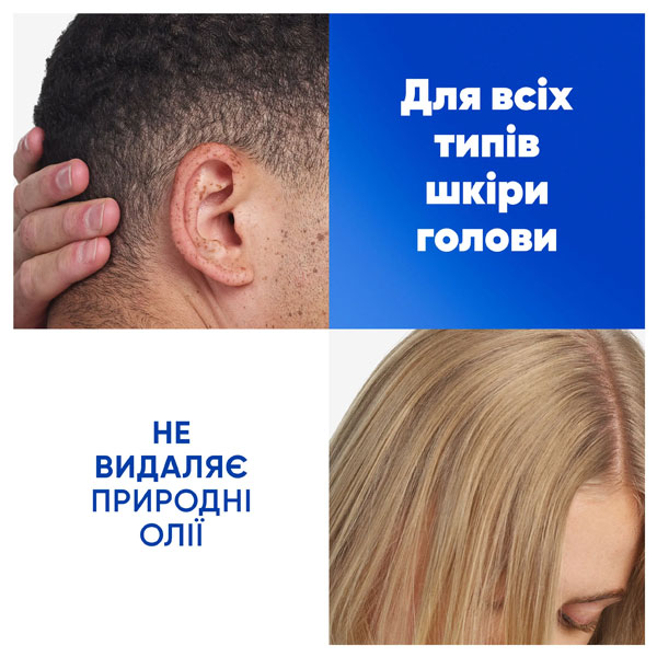 Шампунь Head & Shoulders Цитрус 2-в-1 625 мл