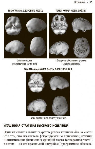 Книга Деніел Амен «Полюби свой мозг. Как превратить свои извилины из наезженной колеи в магистрали успеха» 978-617-7764-3